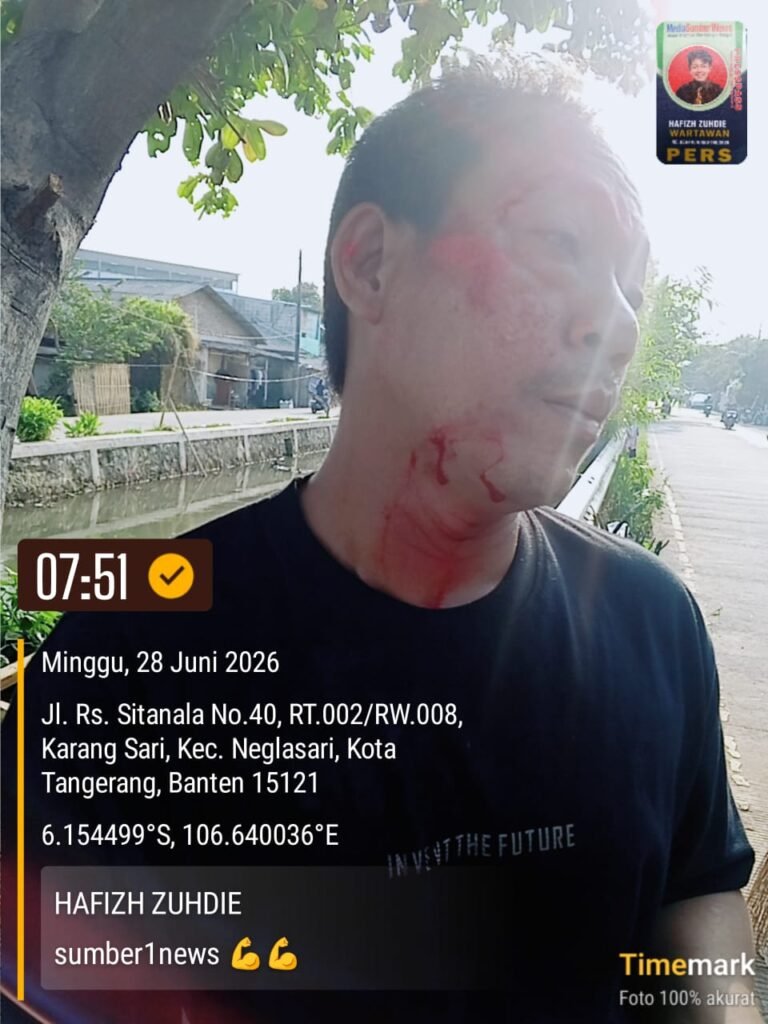 Tikungan Rawan di Neglasari Kembali Makan Korban, Warga Desak Dishub Pasang Polisi Tidur dan Kaca Cekung